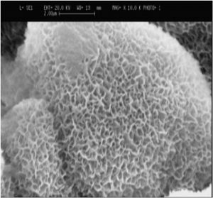 نانو ذرات هیدروکسی آپاتیت