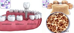 نانو ذرات هیدروکسی آپاتیت